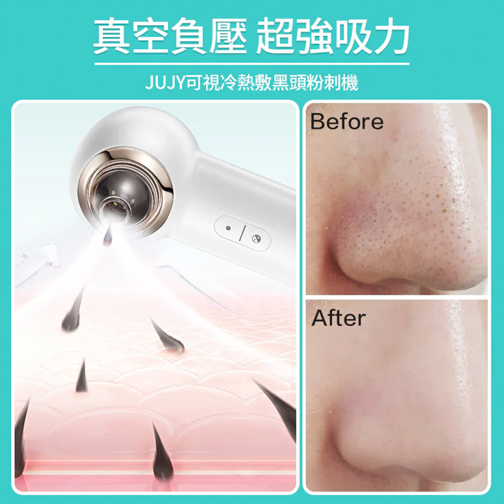 JUJY 紀芝 可視冷熱敷 黑頭粉刺機